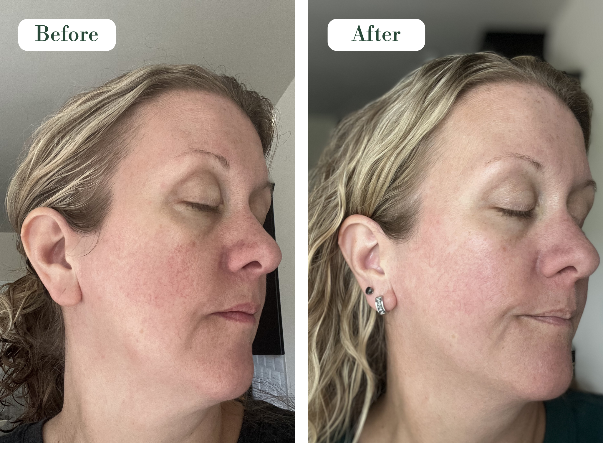 RE-HYDRA SERUM
