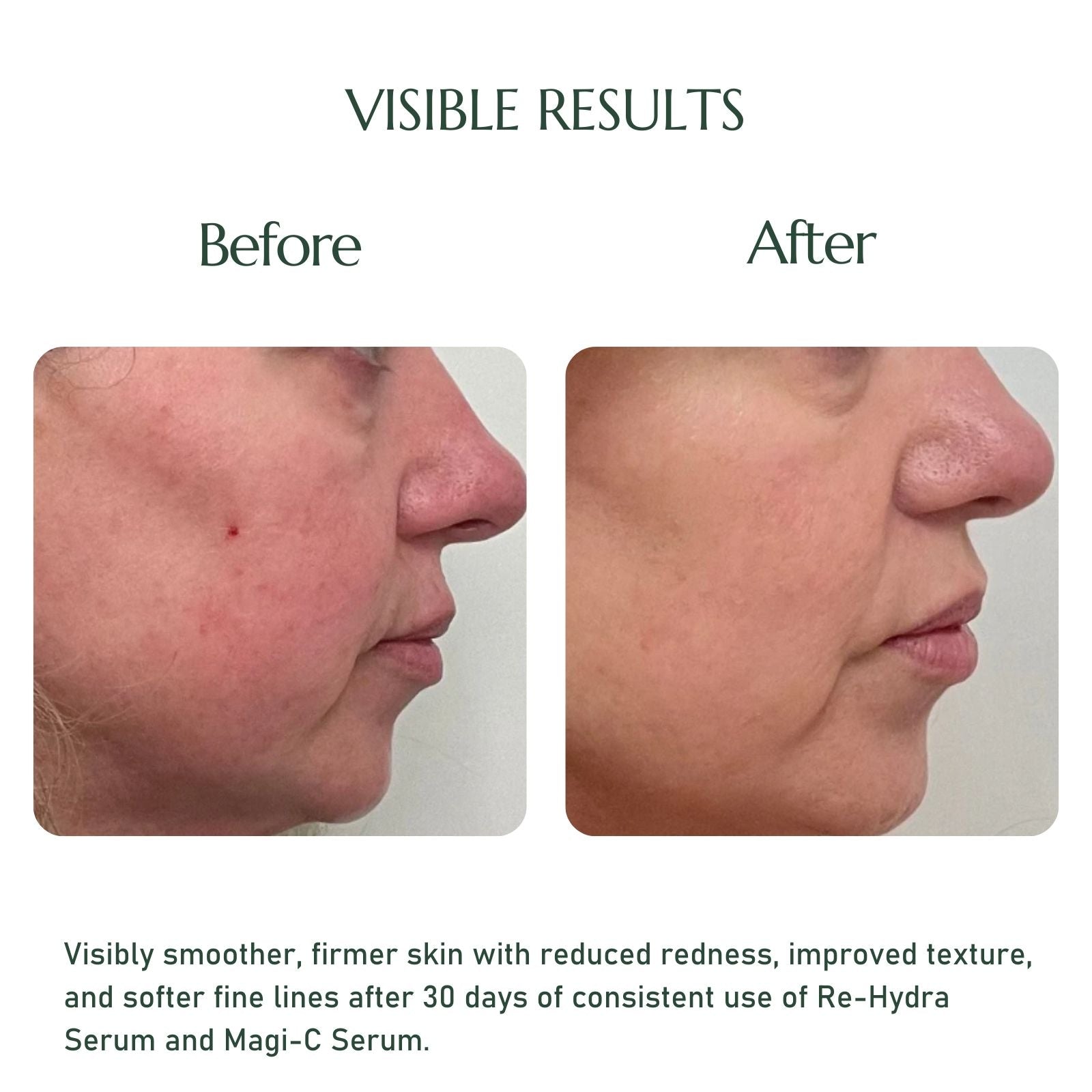 ELASCO Total Radiance Trio