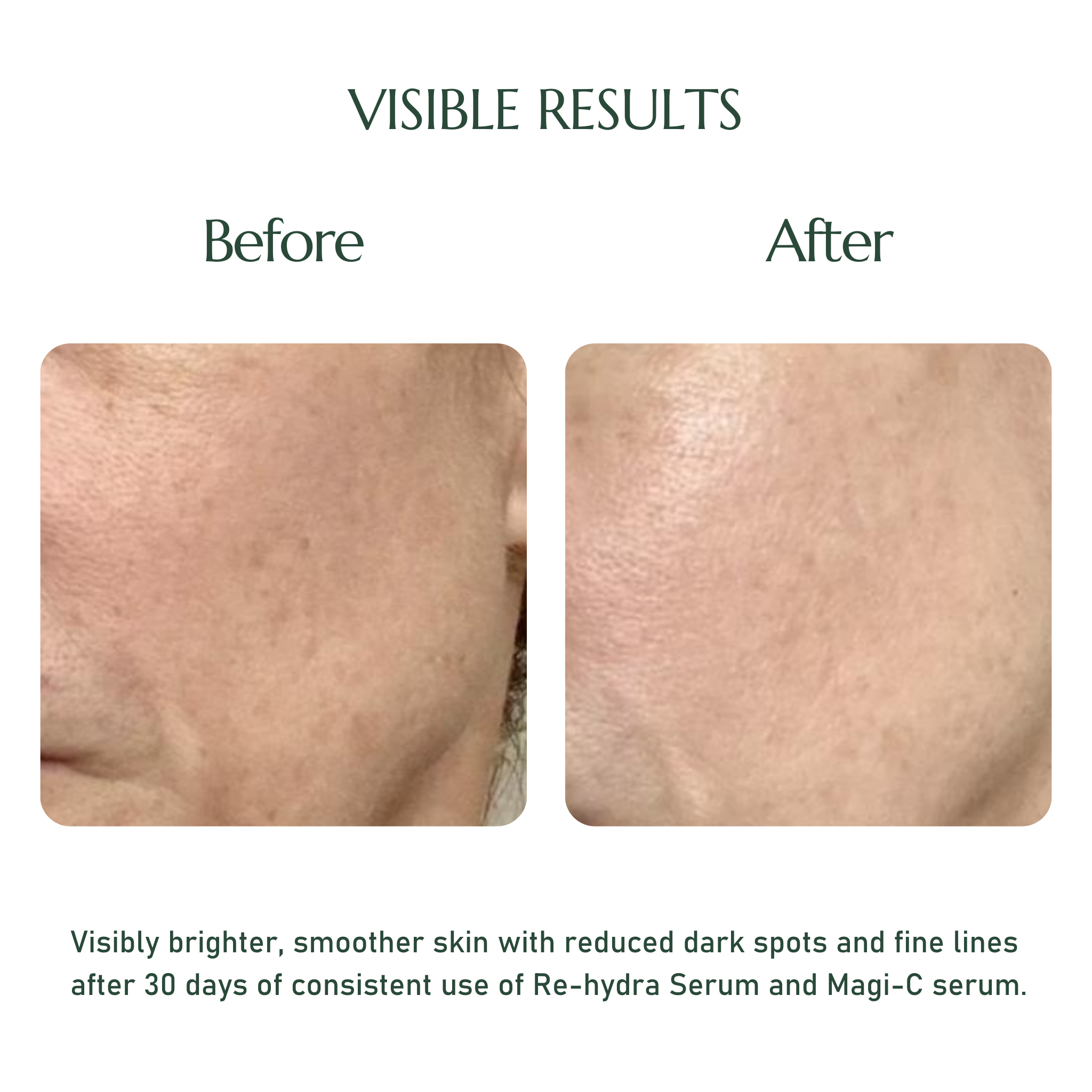 RE-HYDRA SERUM Travel Size