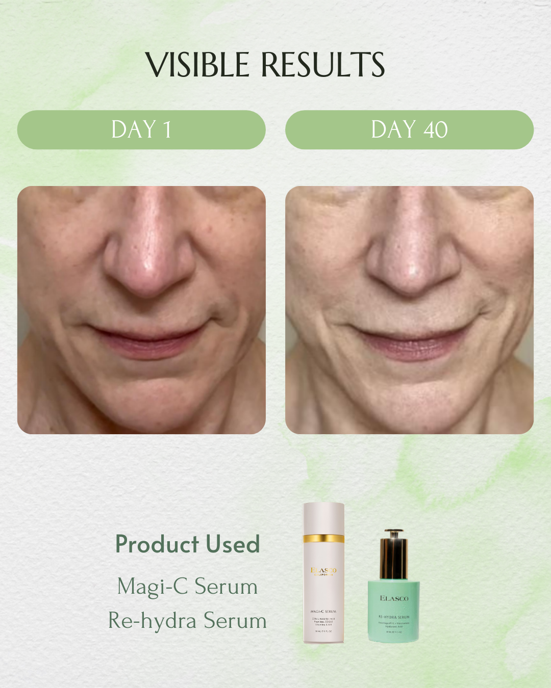 RECOLLAGEN® III RE-HYDRA SERUM