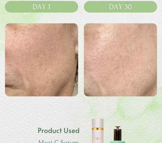 RECOLLAGEN® III RE-HYDRA SERUM