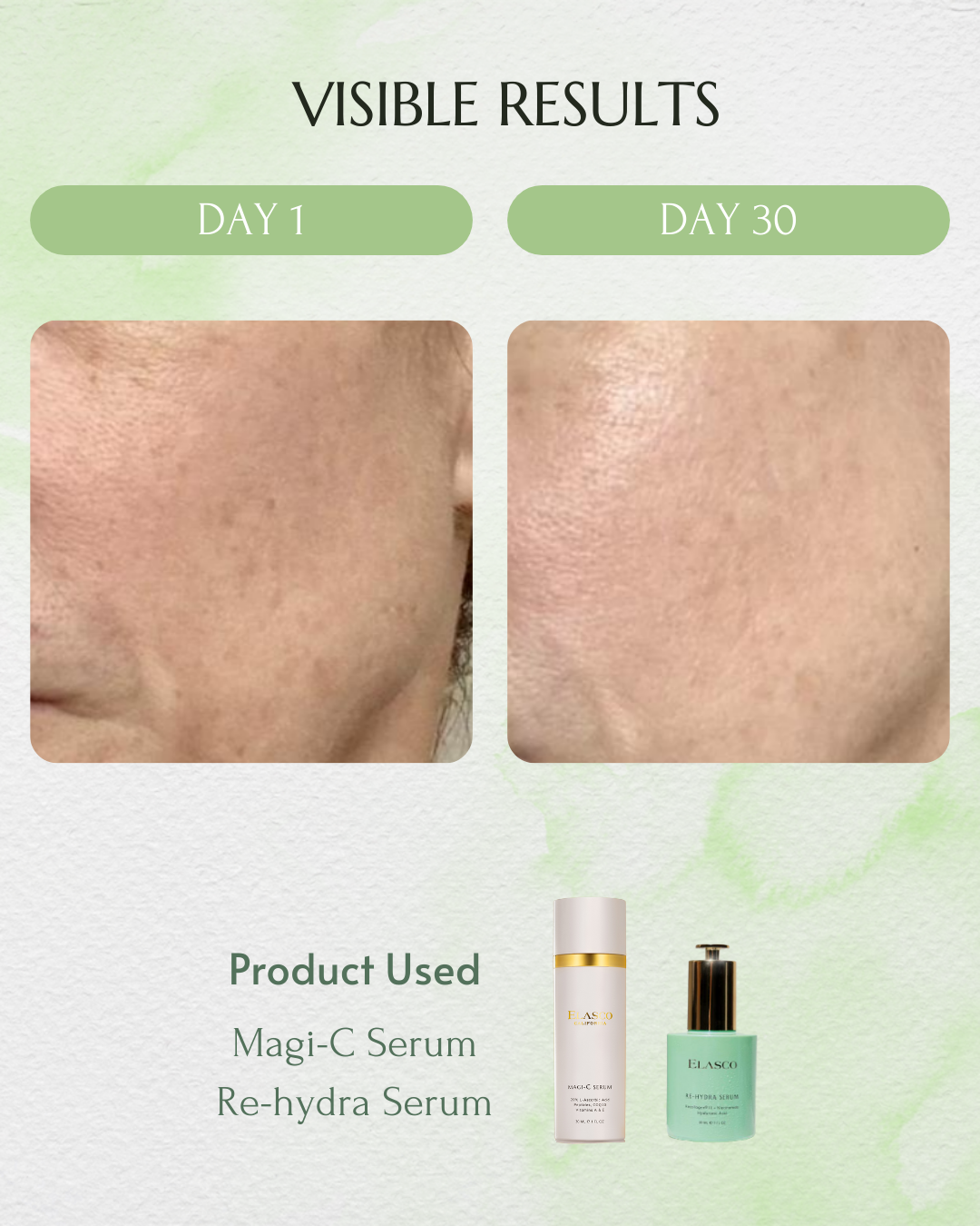RECOLLAGEN® III RE-HYDRA SERUM