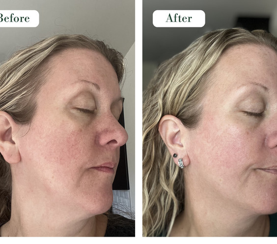 RE-HYDRA SERUM