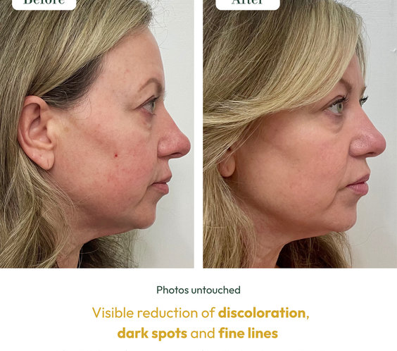 RE-HYDRA SERUM