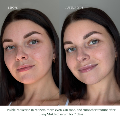 MAGI-C SERUM