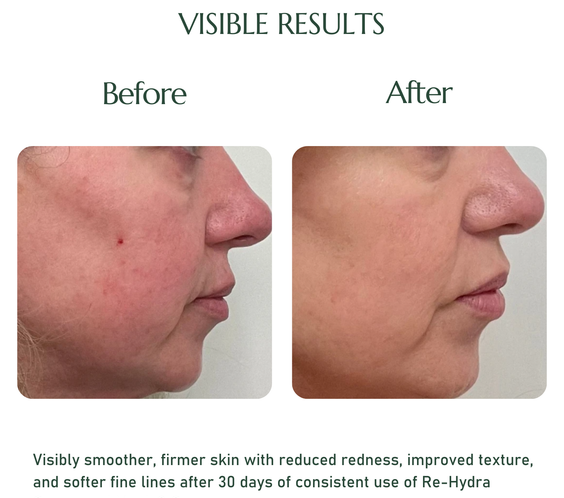 20% L-ASCORBIC ACID MAGI-C SERUM