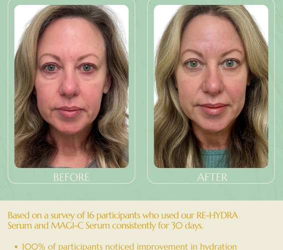 RECOLLAGEN® III RE-HYDRA SERUM