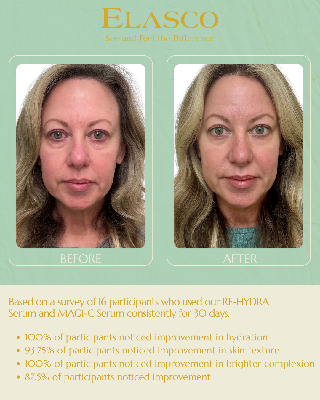 RECOLLAGEN® III RE-HYDRA SERUM – ELASCO SKINCARE