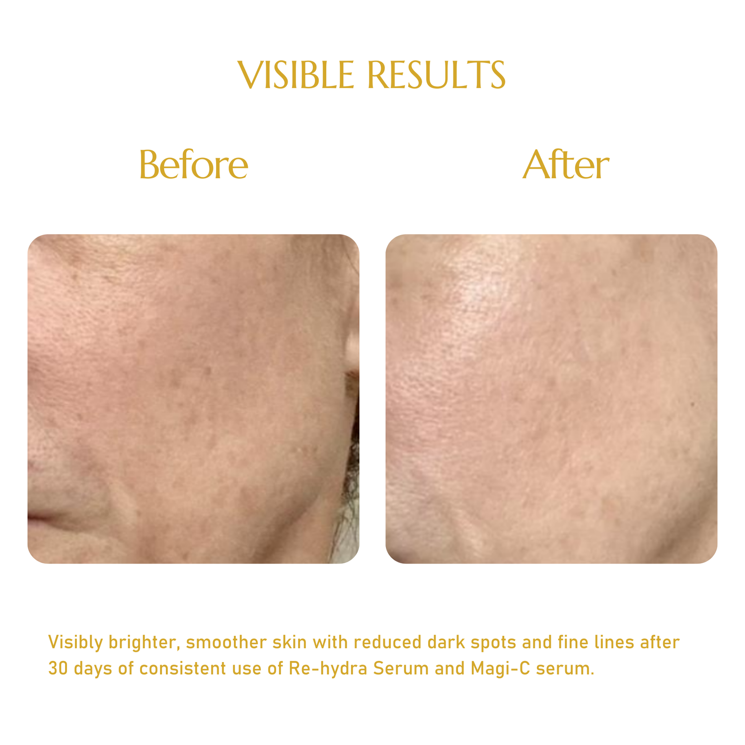 RE-HYDRA SERUM