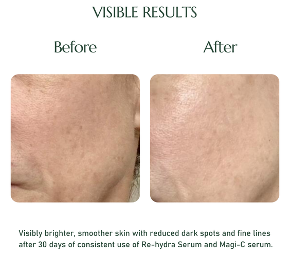 20% L-ASCORBIC ACID MAGI-C SERUM