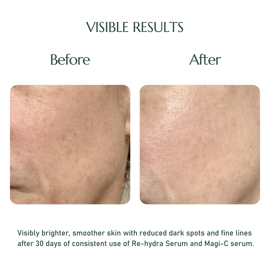 ELASCO Glow Essence Duo