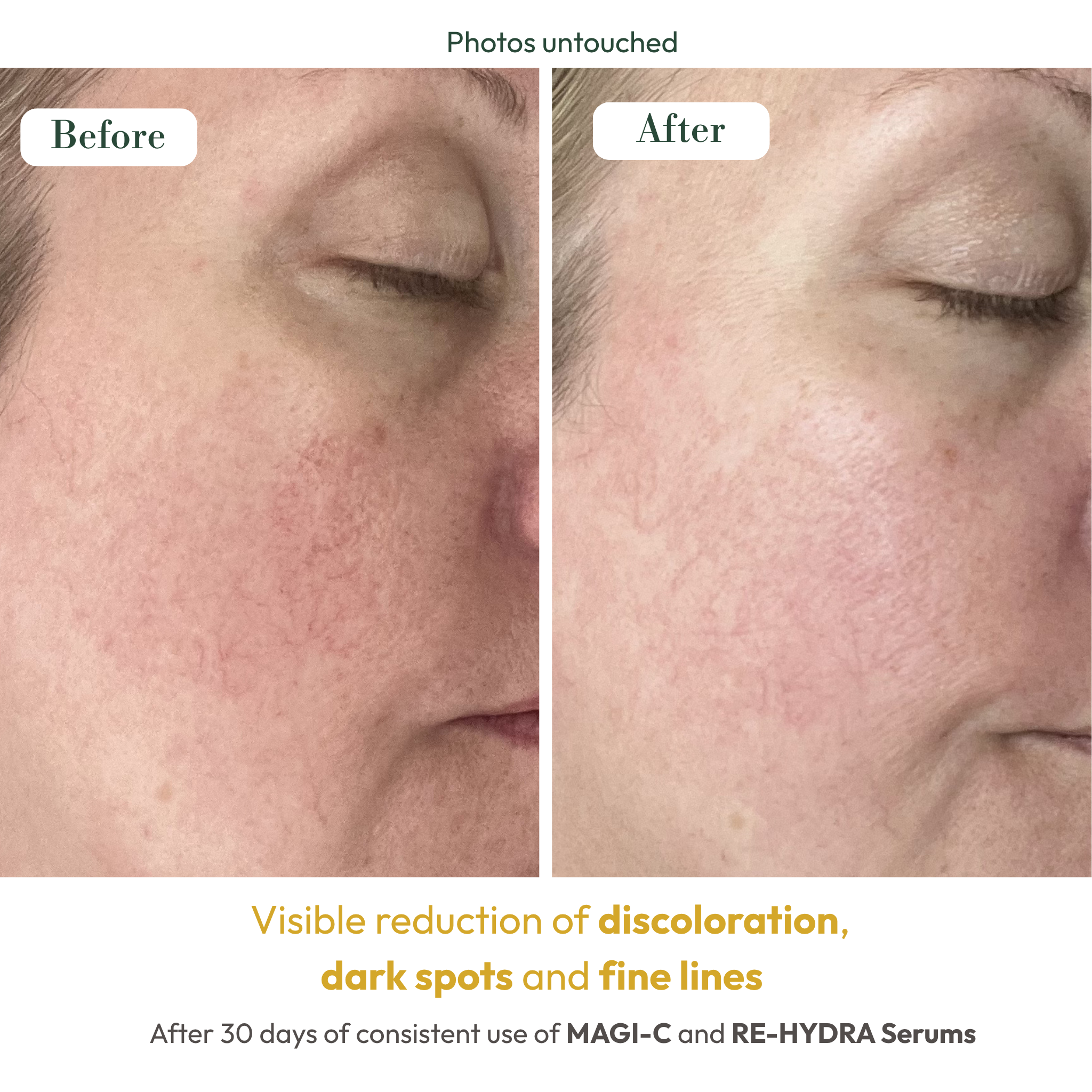 ELASCO Glow Essence Duo